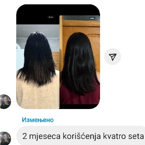 kvatro set