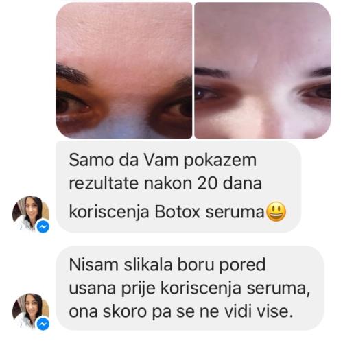 botox trio