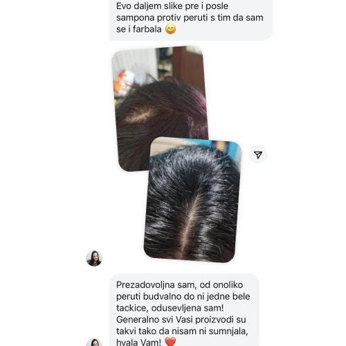 dandruf Å¡amp