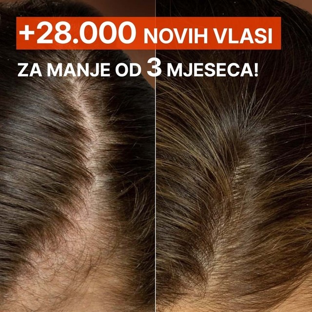 image(2)
